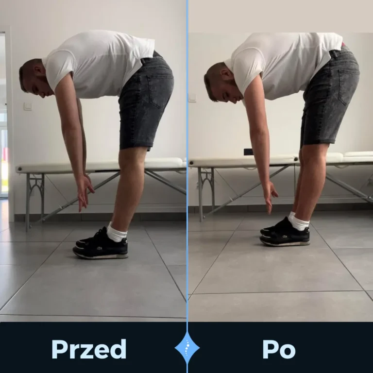 PRZED I PO-1