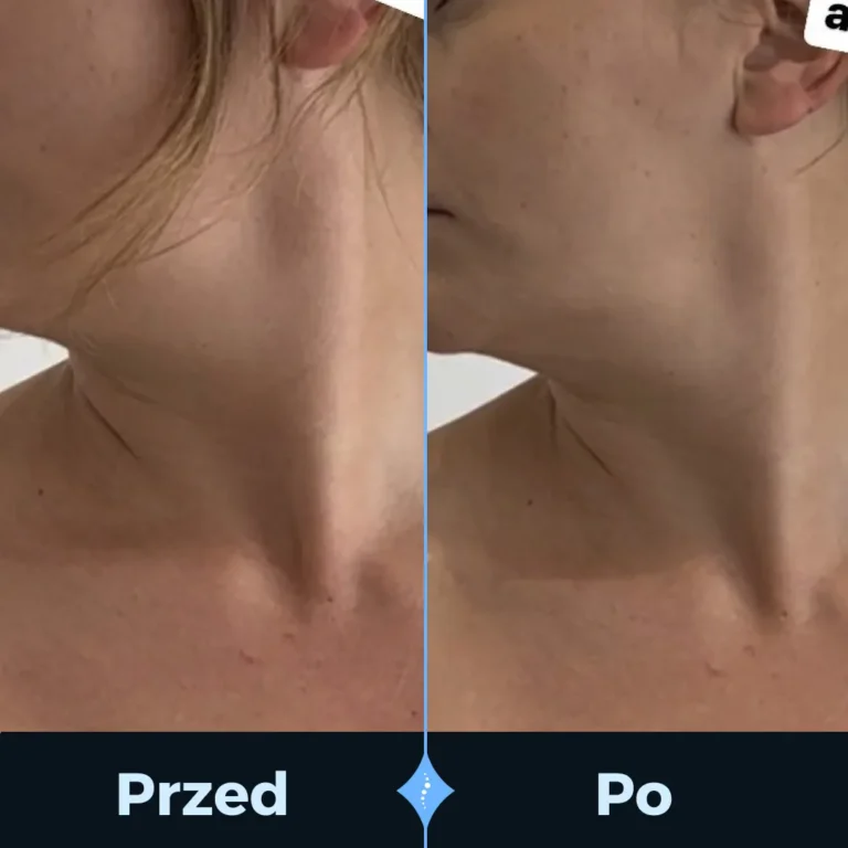 PRZED I PO (1)