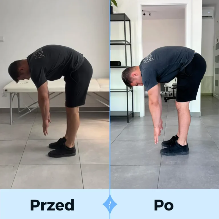 PRZED I PO-2